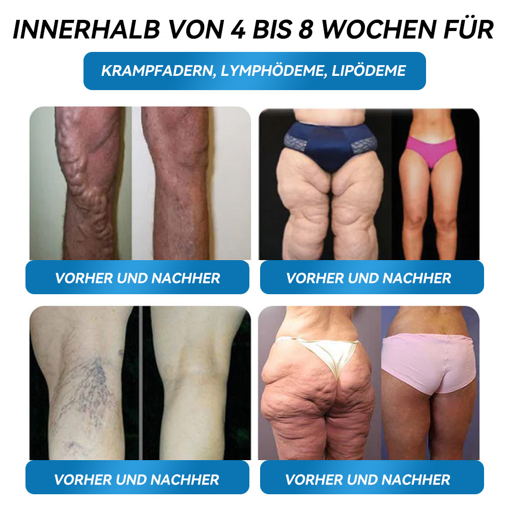 30% RABATT📢𝐋𝐄𝐑𝐂𝐄𝐀® 𝐆𝑳𝐏-𝟏 𝐌𝐞𝐭𝐚𝐛𝐨𝐥𝐢𝐬𝐜𝐡𝐞 𝐁𝐚𝐥𝐚𝐧𝐜𝐞 𝐓𝐫𝐢𝐧𝐤𝐚𝐦𝐩𝐮𝐥𝐥𝐞💎