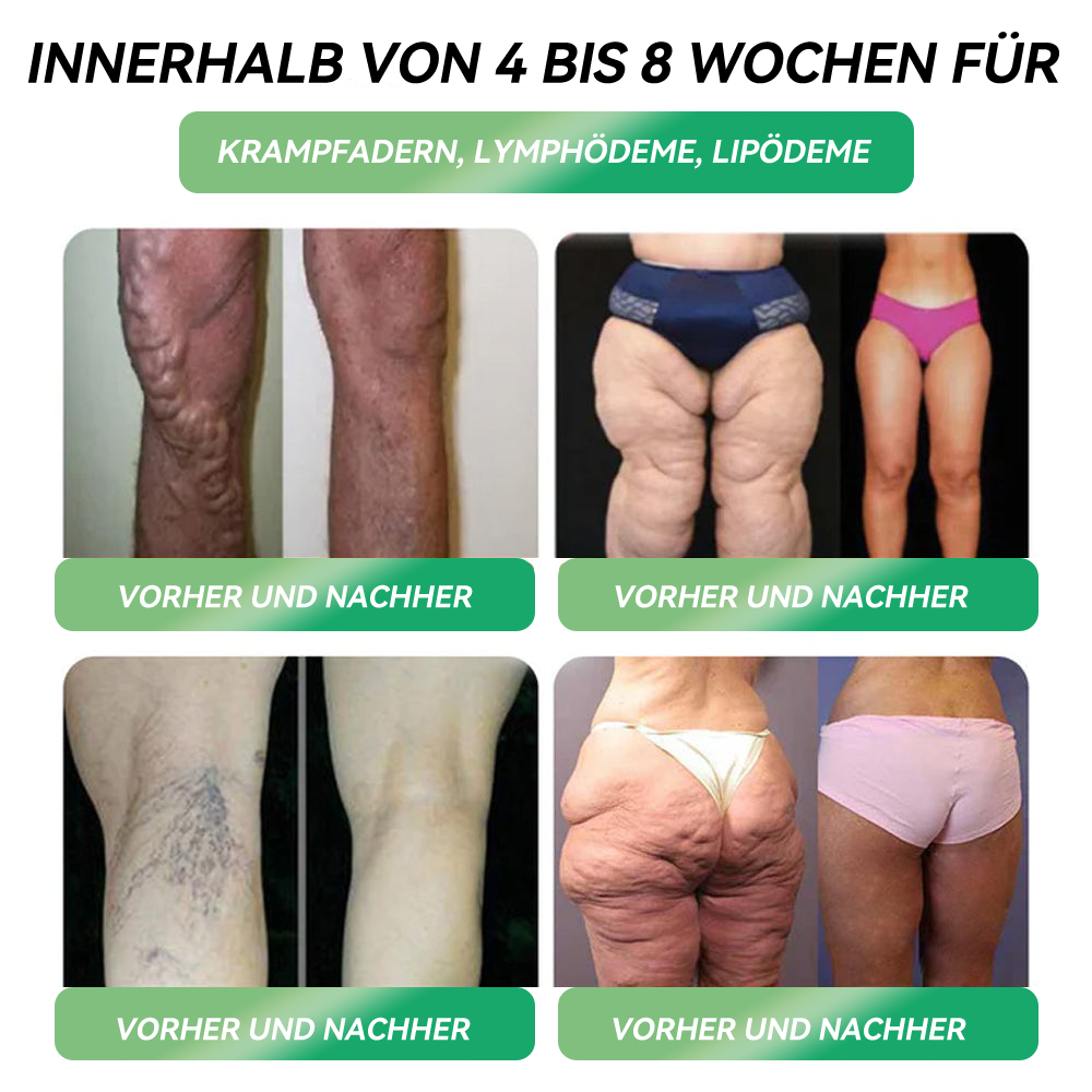 𝐕𝐨𝐧 Ä𝐫𝐳𝐭𝐞𝐧 𝐞𝐦𝐩𝐟𝐨𝐡𝐥𝐞𝐧, 𝐮𝐧𝐭𝐞𝐫𝐬𝐭ü𝐭𝐳𝐭 𝐝𝐮𝐫𝐜𝐡 𝐝𝐢𝐞 𝐆𝐊𝐕 👩‍⚕️| 𝗟𝗘𝑹𝗖𝗘𝗔® 𝐆𝐋𝐏-𝟏 𝗠𝘂𝗹𝘁𝗶𝗳𝘂𝗻𝗸𝘁𝗶𝗼𝗻𝗮𝗹𝗲 𝗧𝗿𝗶𝗻𝗸𝗮𝗺𝗽𝘂𝗹𝗹𝗲𝗻 💎 𝐅ü𝐫 𝐅𝐞𝐭𝐭𝐥𝐞𝐢𝐛𝐢𝐠𝐤𝐞𝐢𝐭, 𝐤𝐚𝐫𝐝𝐢𝐨𝐯𝐚𝐬𝐤𝐮𝐥ä𝐫𝐞 𝐆𝐞𝐬𝐮𝐧𝐝𝐡𝐞𝐢𝐭, 𝐃𝐢𝐚𝐛𝐞𝐭𝐞𝐬, 𝐒𝐜𝐡𝐥𝐚𝐟𝐚𝐩𝐧𝐨𝐞, 𝐆𝐞𝐥𝐞𝐧𝐤𝐩𝐫𝐨𝐛𝐥𝐞𝐦𝐞 𝐮𝐧𝐝 𝐦𝐞𝐡𝐫🎁