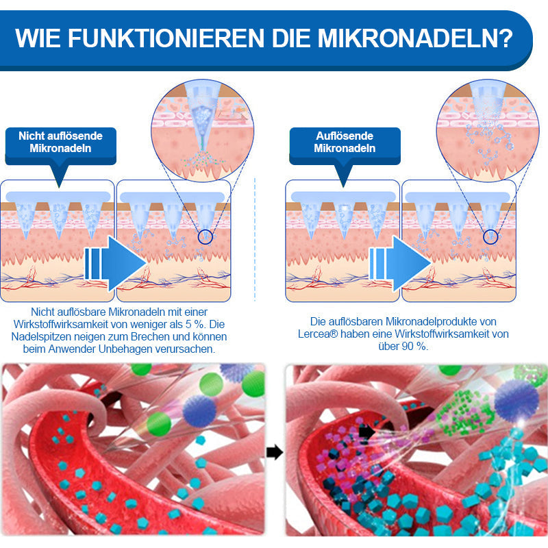 【👩‍⚕️Letzter Tag Aktion – 60 % RABATT】🌟𝐋𝑬𝘙𝐶𝘌𝘼® 𝐒𝐌𝐆𝐓-𝐆𝐋𝐏-𝟏 𝐓𝐢𝐫𝐳𝐞𝐩𝐚𝐭𝐢𝐝𝐞 & 𝐊𝐨𝐥𝐥𝐚𝐠𝐞𝐧-𝐍𝐚𝐧𝐨-𝐌𝐢𝐤𝐫𝐨𝐧𝐚𝐝𝐞𝐥-𝐏𝐟𝐥𝐚𝐬𝐭𝐞𝐫🏅